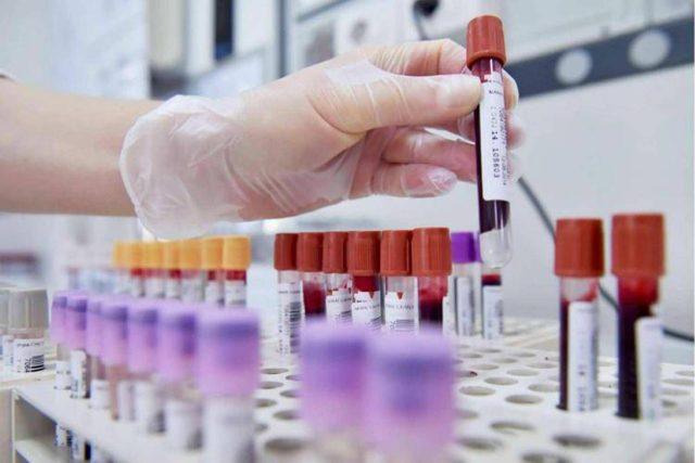 Tumore allo stomaco in stadio precoce, con immunoterapia 69% pazienti vivo a 3 anni