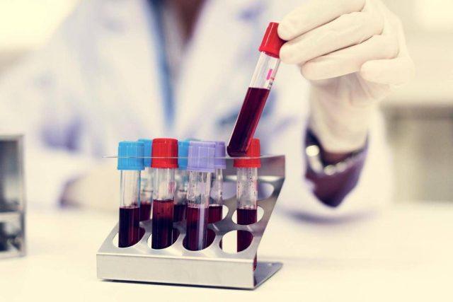 Come vivere più a lungo? Il test del sangue svela la longevità