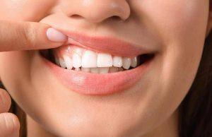 Denti a rischio tra i giovani, Sidp: “Il 36% della Gen Z ha gengive che sanguinano”