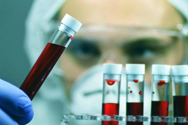 Salute, da Fedemo appello per autosufficienza nazionale sangue e plasmaderivati