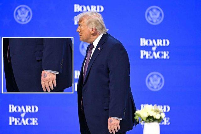 Trump, nuovo grande livido sul dorso della mano sinistra: il dettaglio non passa inosservato
