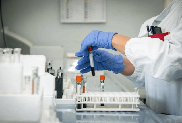 Alzheimer, test del sangue possono prevedere l’inizio dei sintomi