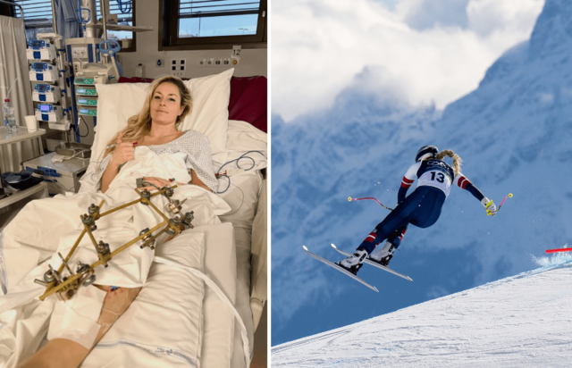 Lindsey Vonn, terzo intervento dopo l’infortunio: “Sto facendo progressi”