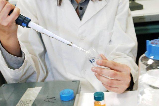 Tumore al seno, scoperto interruttore molecolare che frena la progressione
